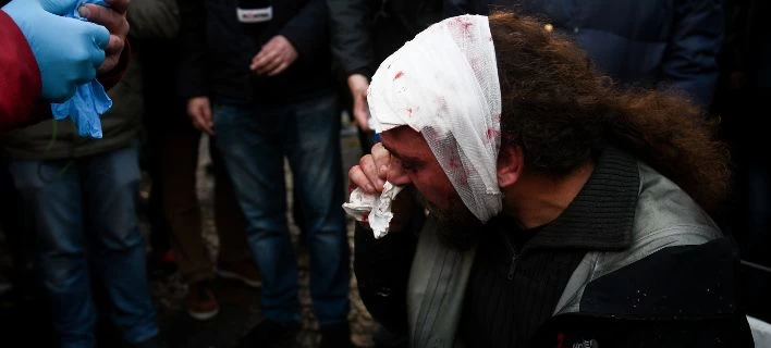 Καταγγελία Ενωσης Φωτορεπόρτερ: Προσχεδιασμένη η επίθεση -Οι κουκουλοφόροι είχαν φωτογραφίες συναδέλφων μας